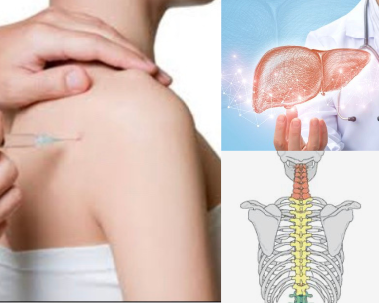 terapia neural e fígado dor na coluna